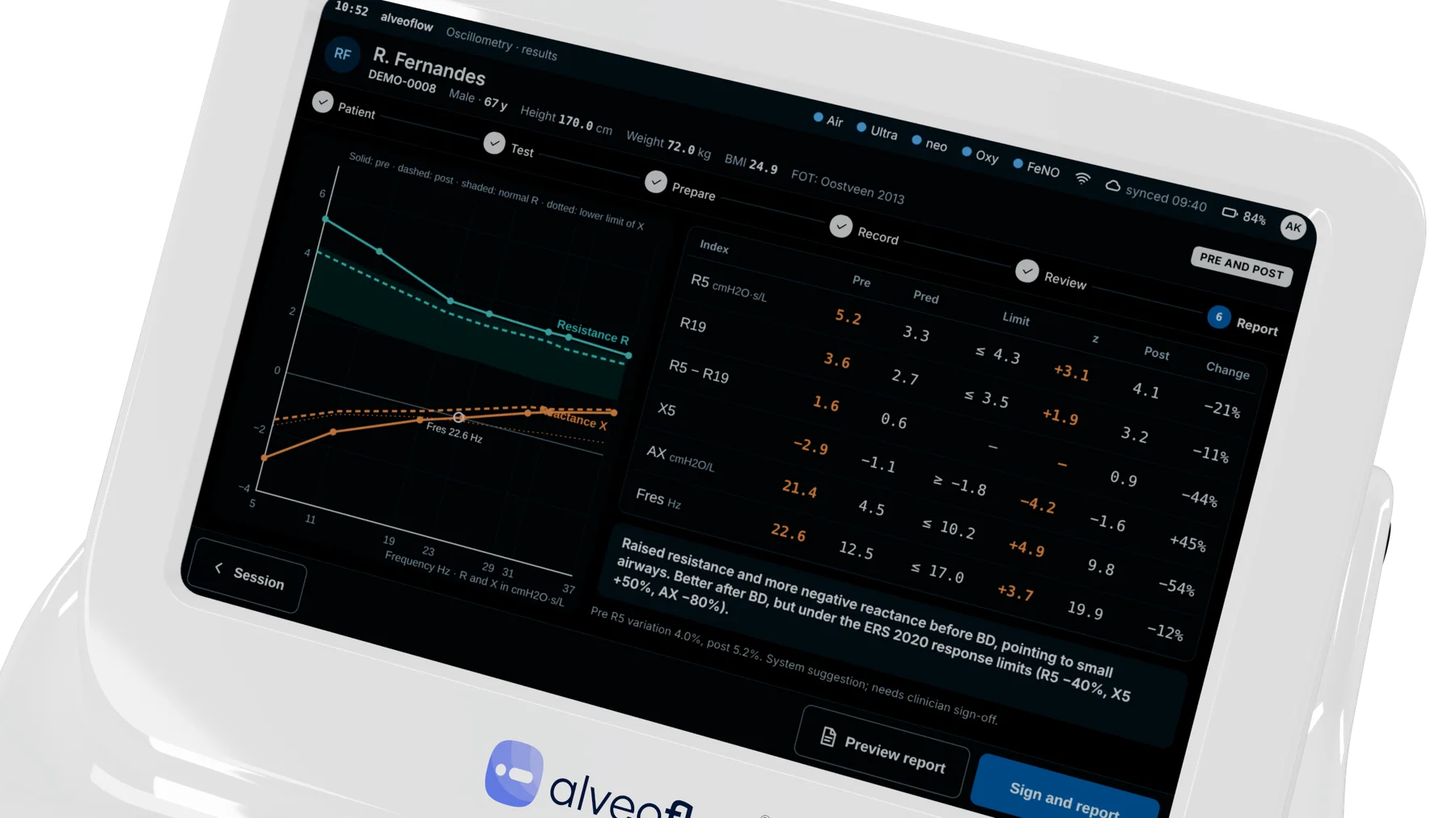 Oscillometry results on the alveoflow Pro screen