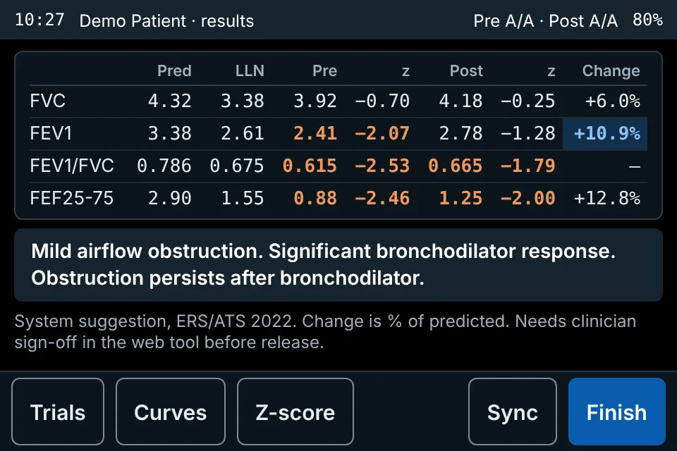 Ultra results screen with pre and post values